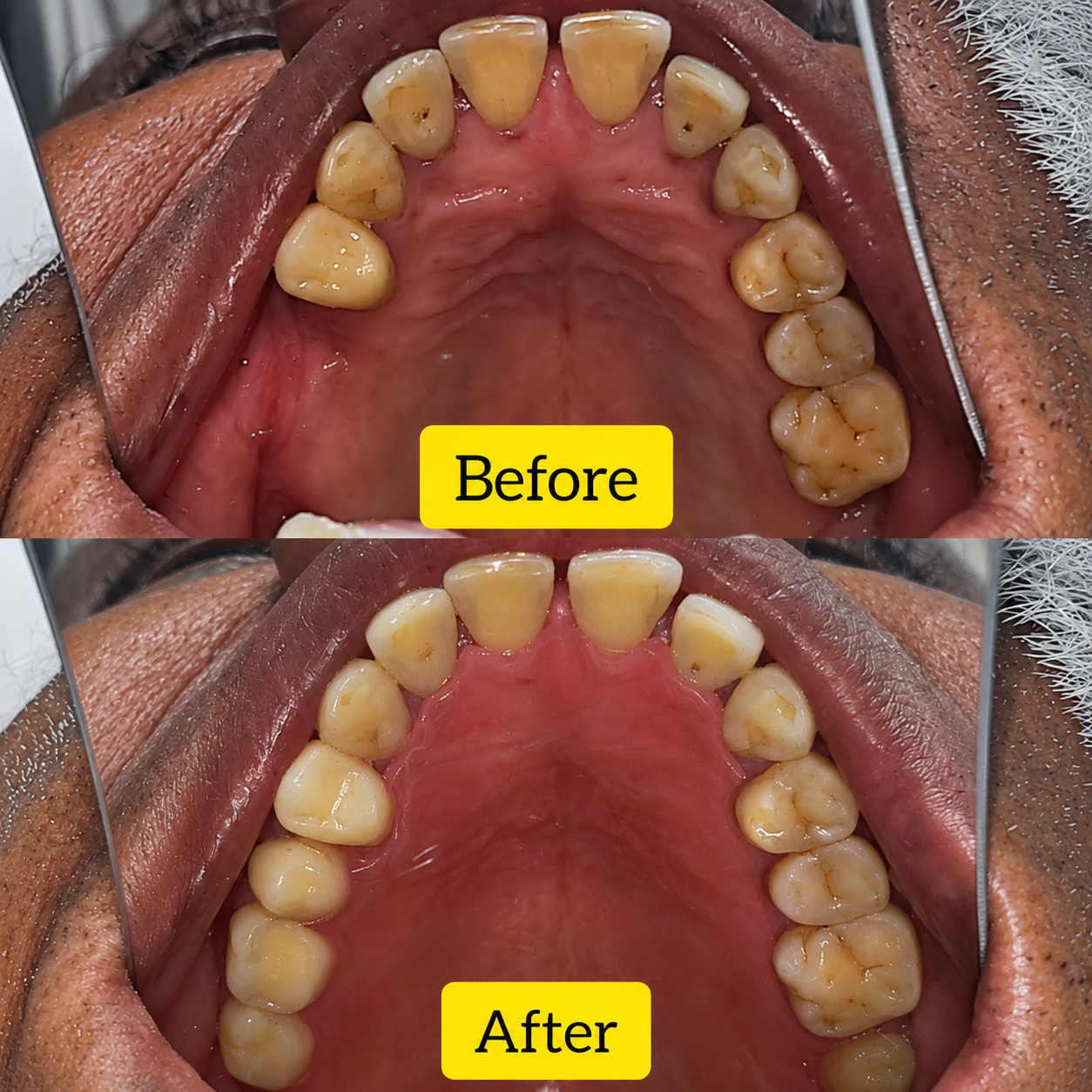 Case 4 Before and After